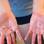 How To Avoid Calluses When Lifting? 5 Suggestions